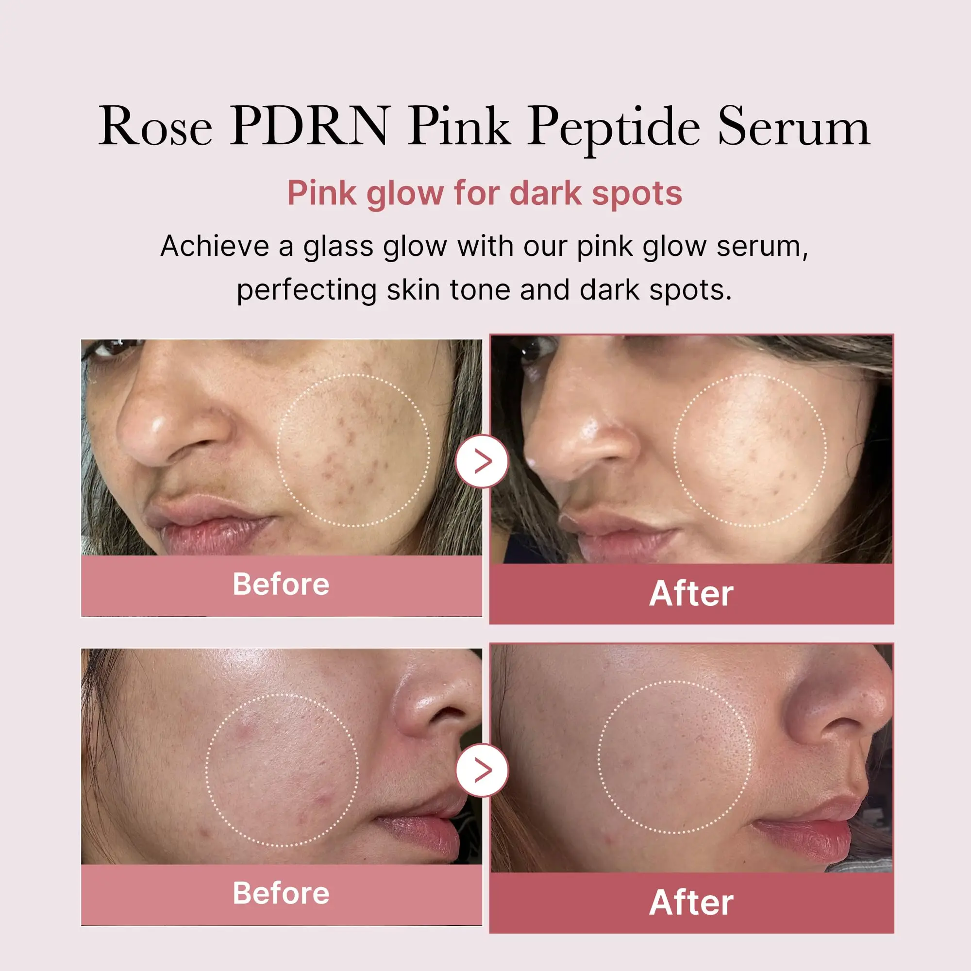 Wholesale Customized Same Medicube PDRN Pink Peptide Serum Korea Vegan Skincare Hydrating Moisturizing Firming Even Skin Tone