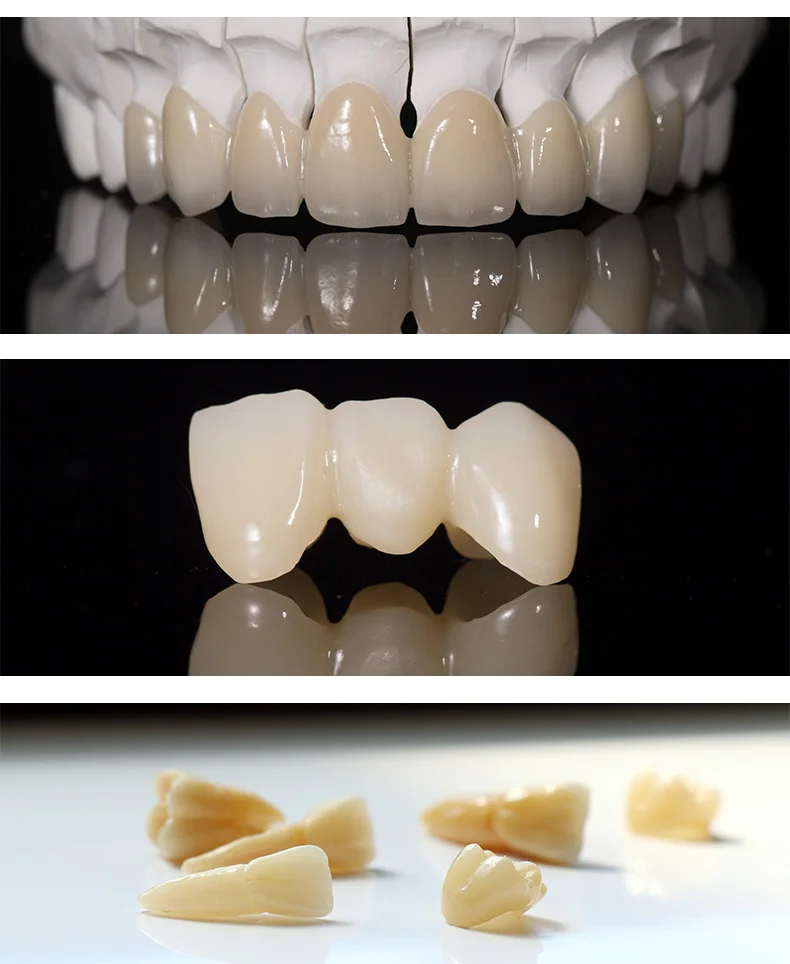 Dental Lab Lithium Disilicate Ceramic Lodden Glass Ceramic C14 Dental