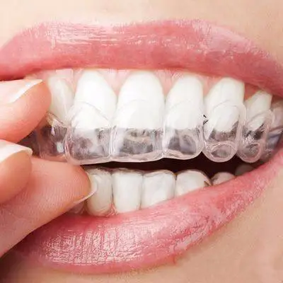 High Quality TPU Material Orthodontic Retainer Teeth Alignment Clear Aligner