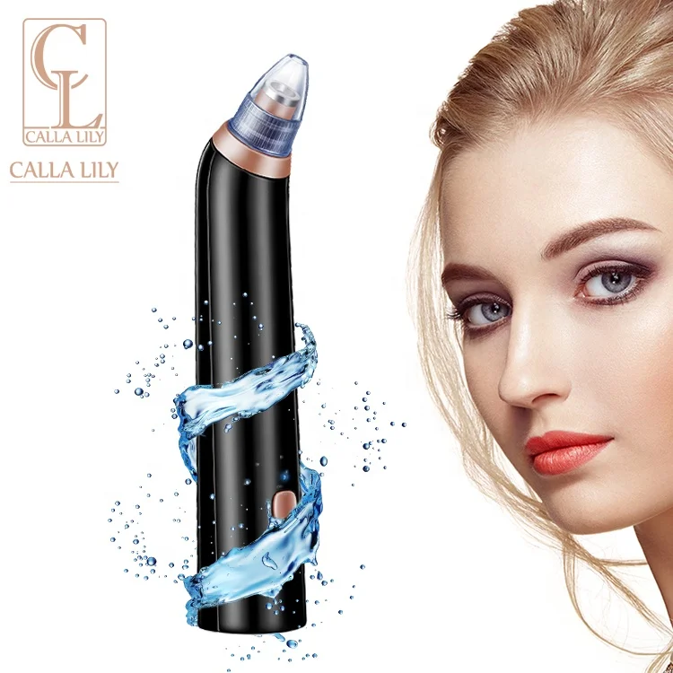 
Легкий способ удаления черных точек на лице, удаление черных точек и белых точек в домашних условиях 