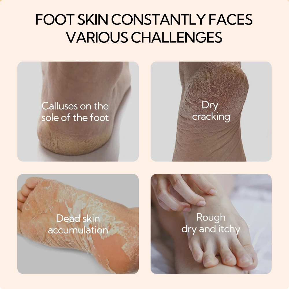 Lanbena Hot Peeling Dead Skin Removal Foot Repair Whitening Foot Cream factory