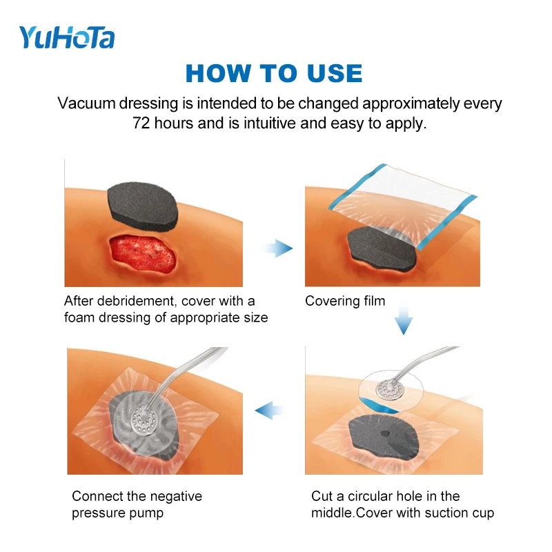 2025 Npwt Most Popular Negative Pressure Wound Therapy System Vac Medical Care NPWT Round Dressing Transparent Wound Dressing