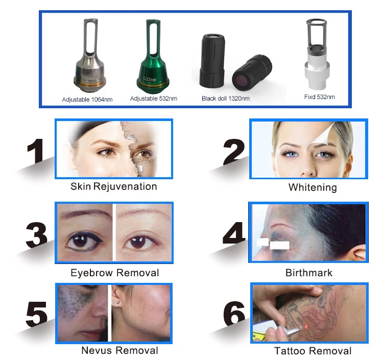 Professional Q Switched Nd Yag Laser eyebrow tattoo Removal
