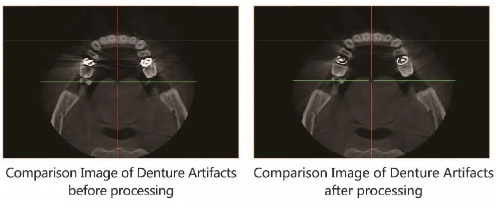 High Quality Digital Radiography 3D CBCT Panoramic Dental X-ray Machine, Teeth Xray Scanner details