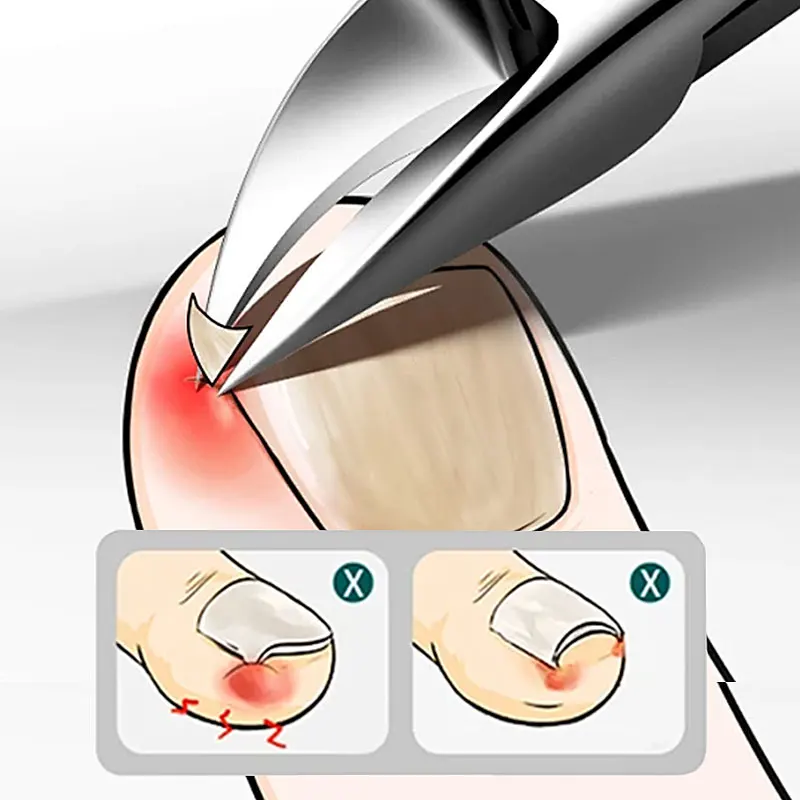 Wholesales Replacement Klhip Nail Clipper Dead Skin Remover K-K512 Ha6d2ee3ac9954dca80d7332f77151114d