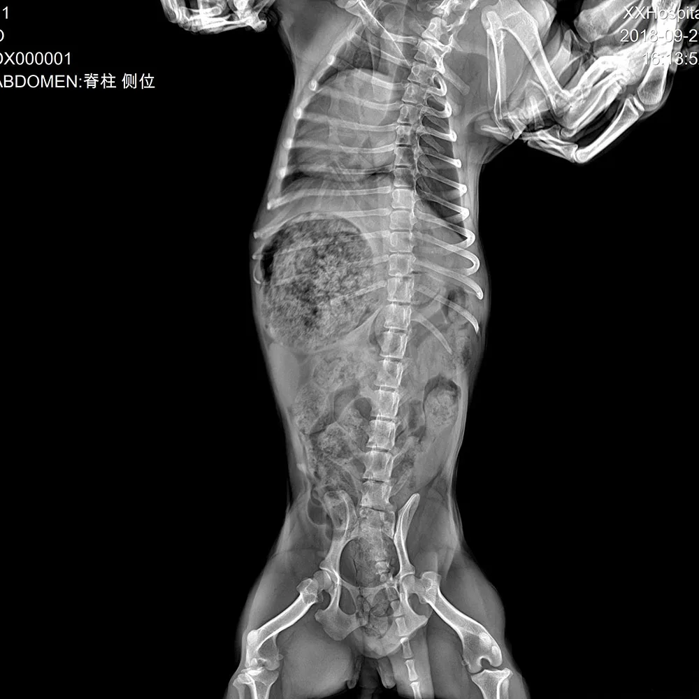 Medical Equipment Manufacturers 17 * 17 Inch X Ray Digital Wireless Detector,  Portable Smart X-ray Flat Panel