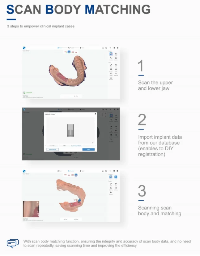 Best Intraoral Dental Scanner