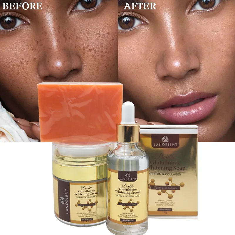 glutathione ebay Private Label Natural Skin Care Whitening Body Lotion Cream Repairing Glutathione Collagen Vitamin E Body Lotion for Dark Skin glutathione ebay Private Label Natural Skin Care Whitening Body Lotion Cream Repairing Glutathione Collagen Vitamin E Body Lotion for Dark Skin