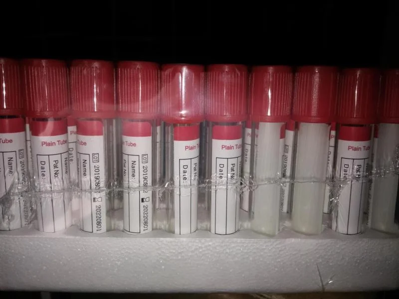 
Обычная трубка для сбора крови красная крышка 