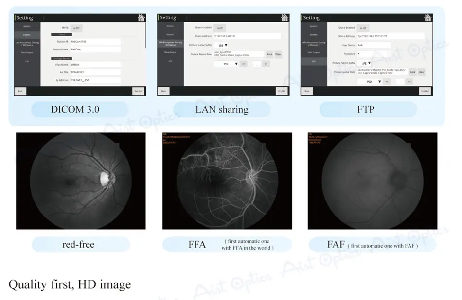 Reticam-3100 Ophthalmic Non-mydriatic Automatic Digital Retinal Fundus Camera