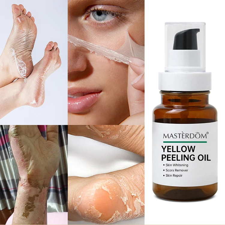 Oem African Extra Strong Bleaching Oil,Dard Skin Dark Knees Knuckles