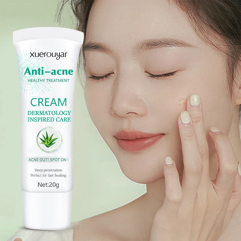 Koreanische Reparatur-Gesichts-Pickel-Akne-Vitamin-C-Lotion OEM  Feuchtigkeitsspendende Porenverkleinernde Gesichtspflege  Bio-Aloe-Vera-Aufhellungs-Gesichtscreme