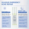 Acne Pore Care face cream