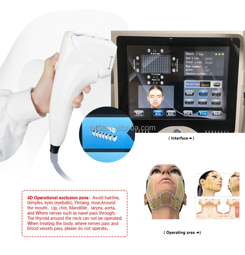 LF-409 best ultrasound hifu therapy 4d hifu eliminate forehead wrinkle machine hot for beauty salon