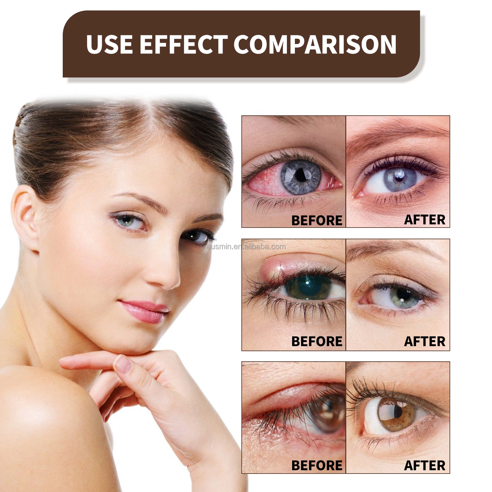 New Arrivals Ultra Eye Lubricant Spray Soothe Eyes Diseases Remove Red ...