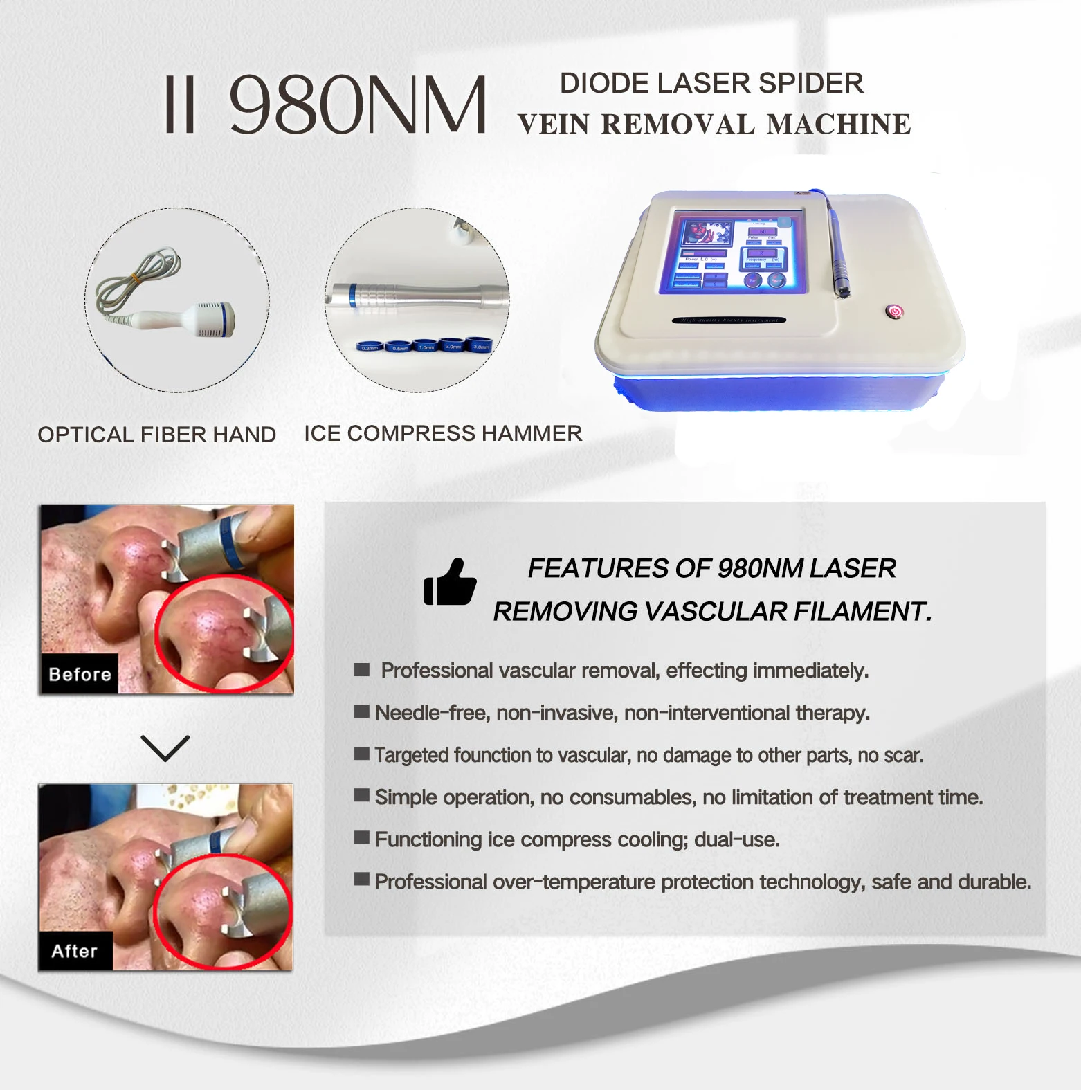 Portable Spider Vein Removal Machine Vascular Removal 980nm Medical