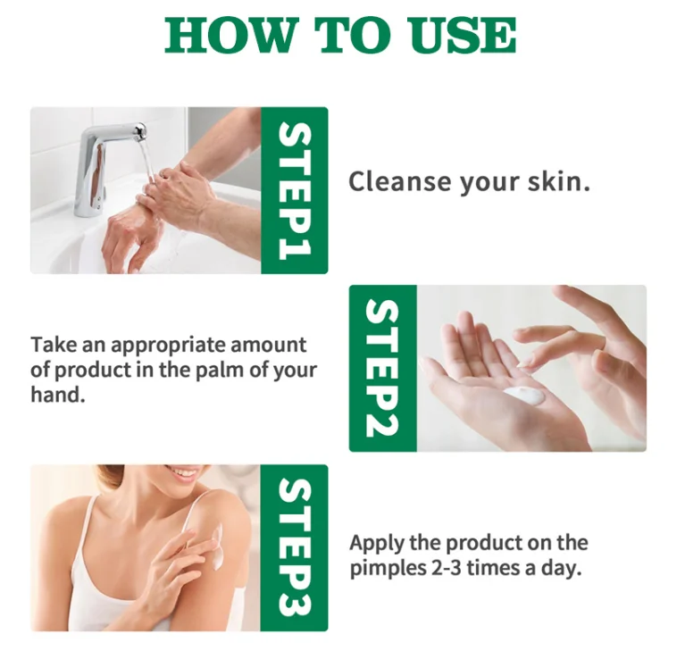 White Spot Removing Body Herbal Skin Care Relief Cream White Spot Removing Body Herbal Skin Care Relief Cream