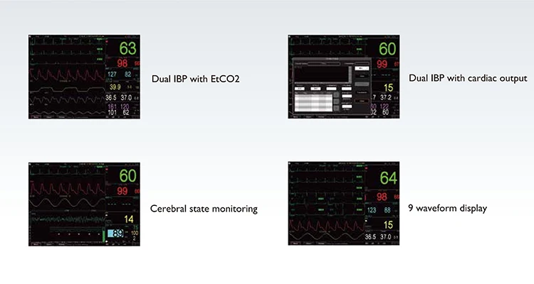 Dual IBP with EtCO2 Dual IBP with Cardiac Output Medical Portable Patient Monitor