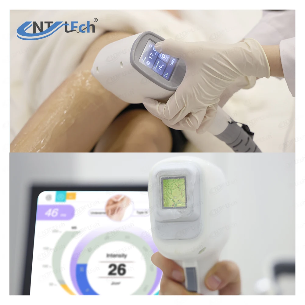 2400Wレーザーパワー高効率ダイオードレーザー脱毛器| Alibaba.com