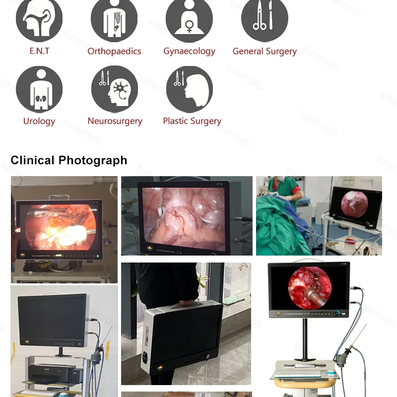 SY-PS050 Surgical Laparoscopic Portable Arthroscopy Camera for ...
