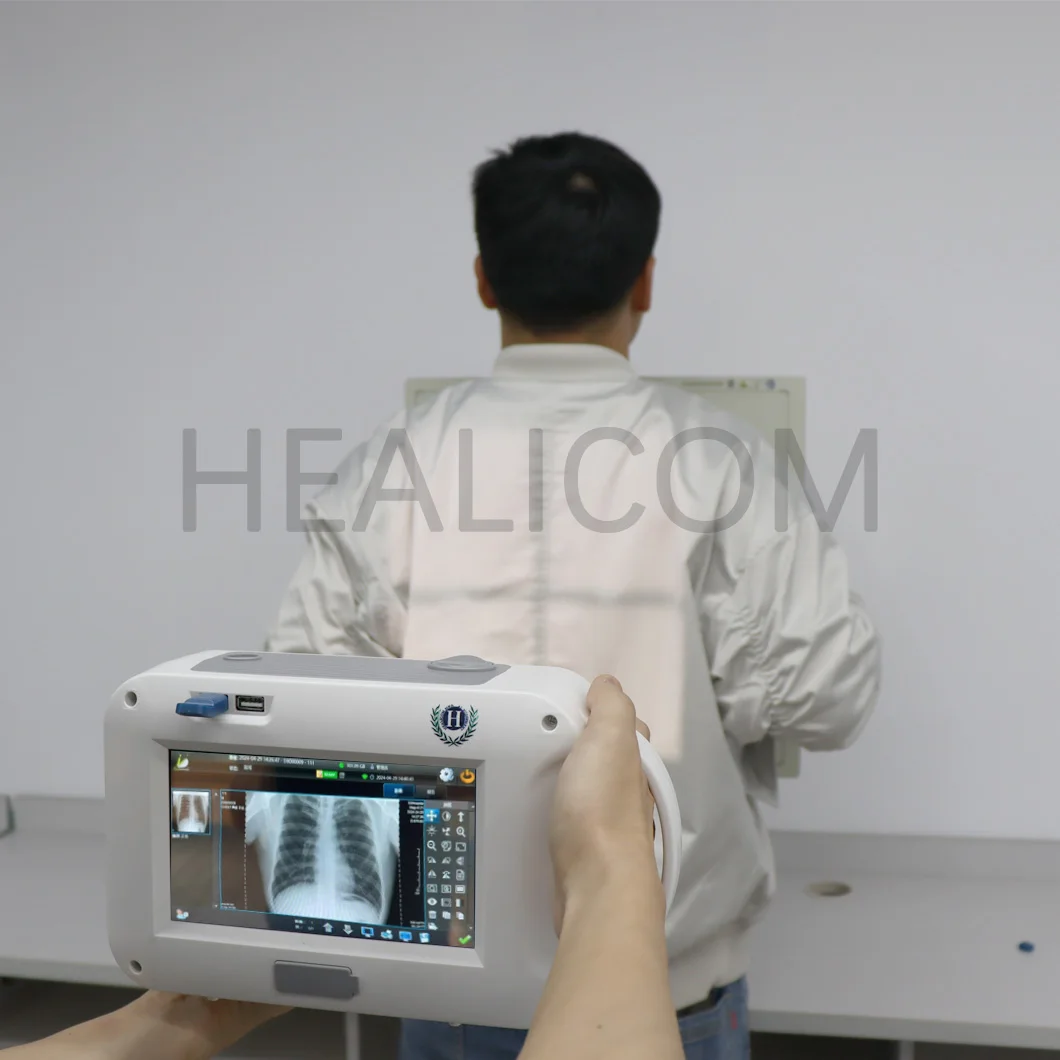 Hot Sale Radiology Equipment Minimize Radiation Portable X Ray Machine System