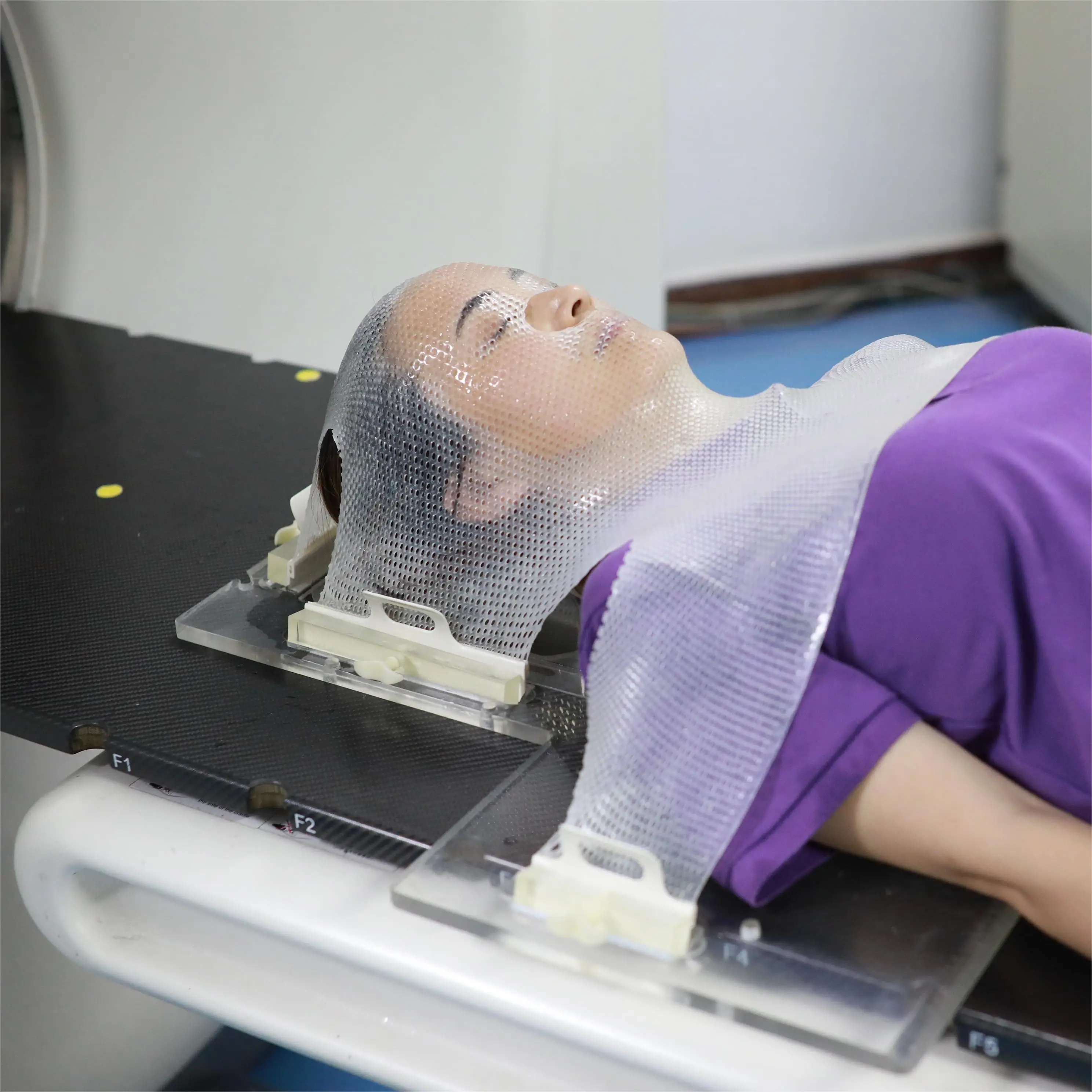 O Type 5-Clamp Thermoplastic Radiotherapy Mask for Cancer Oncology