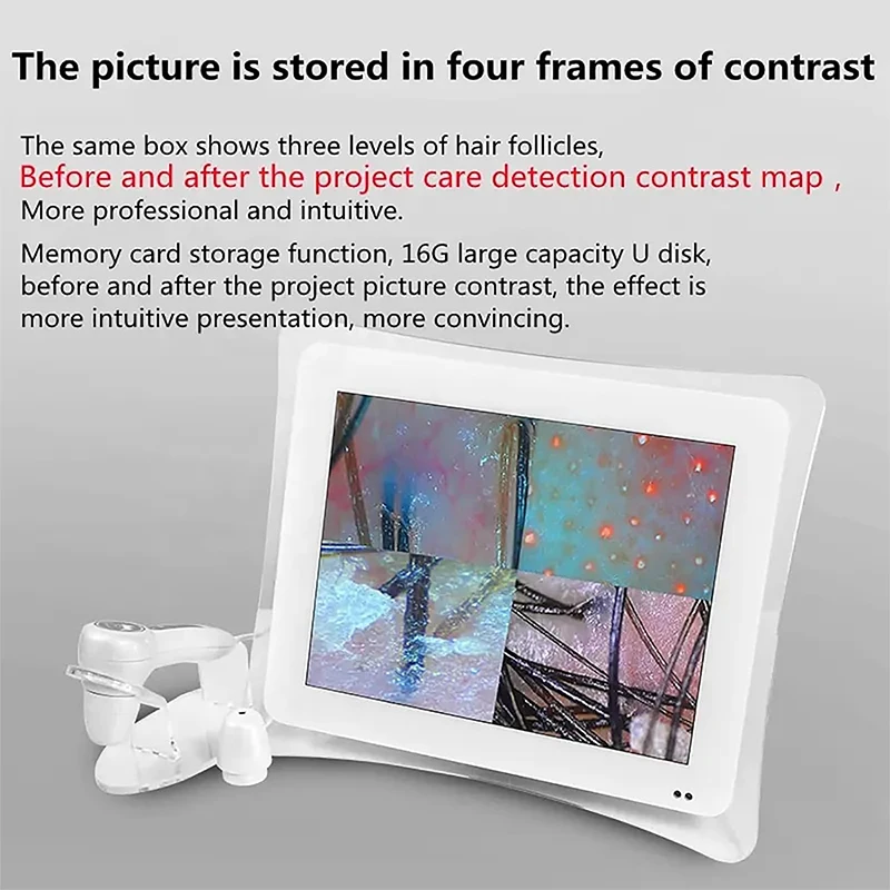 業務用髪＆頭皮のパーソナル診断機 業務用髪＆頭皮のパーソナル