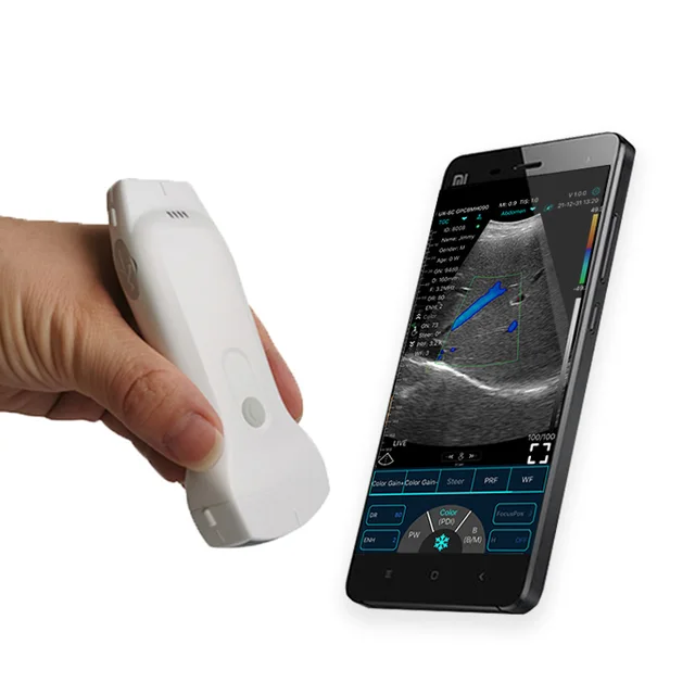 C10RL Usb Ultrasound Scanner Ultrasound Transducer Wireless Handheld Ultrasound Scanner Convex, Linear and Cardiac