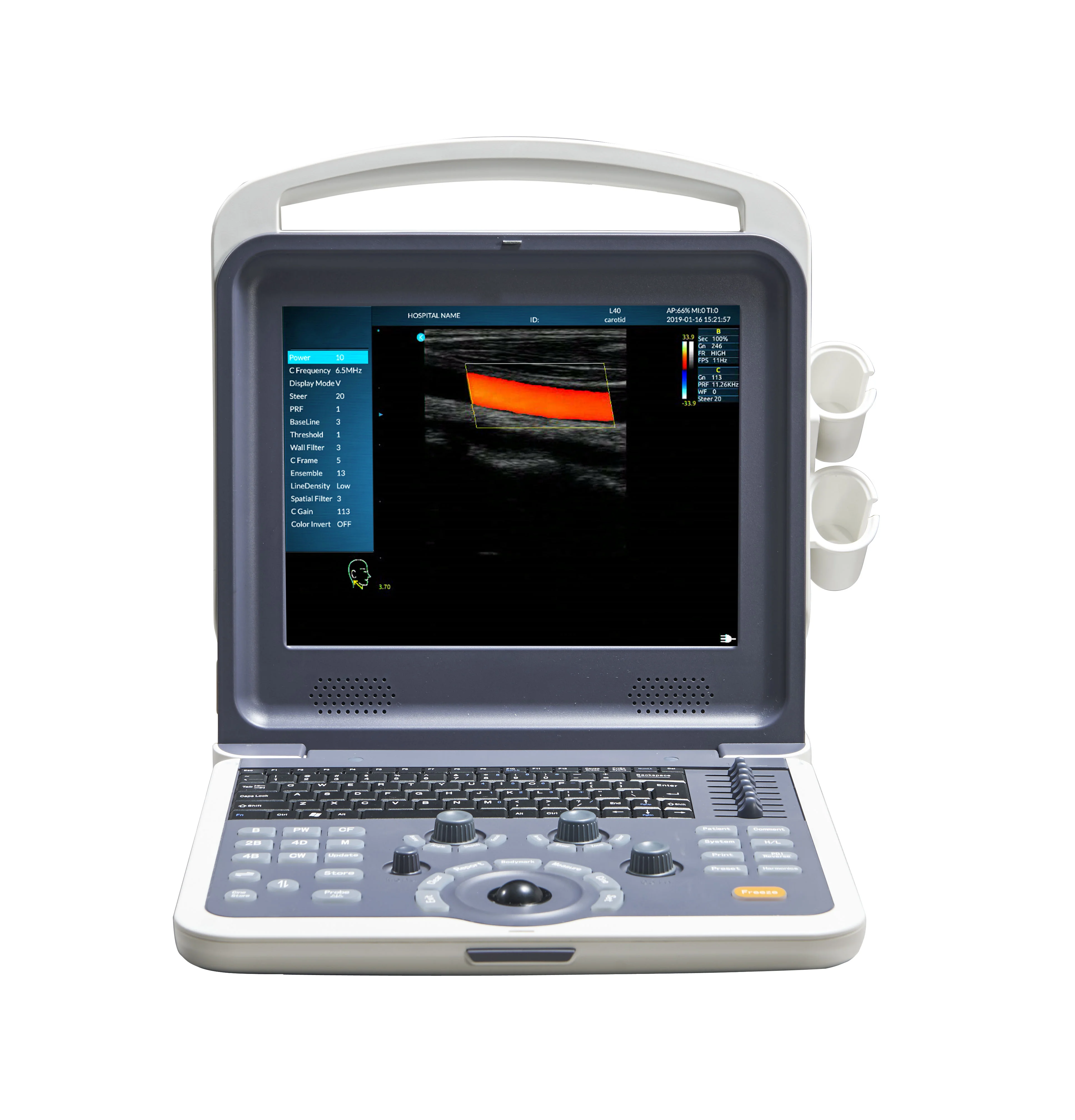 Portable 12 Inch Screen Full Digital Laptop Color Doppler Ultrasound Machine Ultrasonic Diagnostic System for Pet or Human
