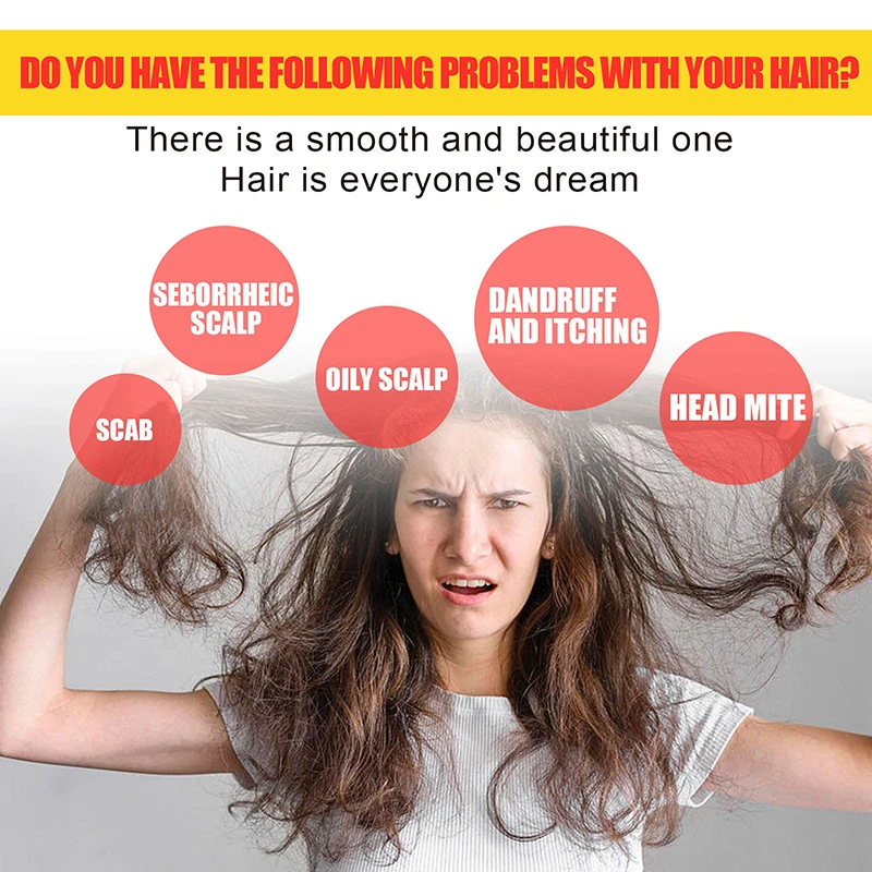 new arrival anti dandruff itchy restore damage hair repair scalp care treatment sulfur massage shampoo