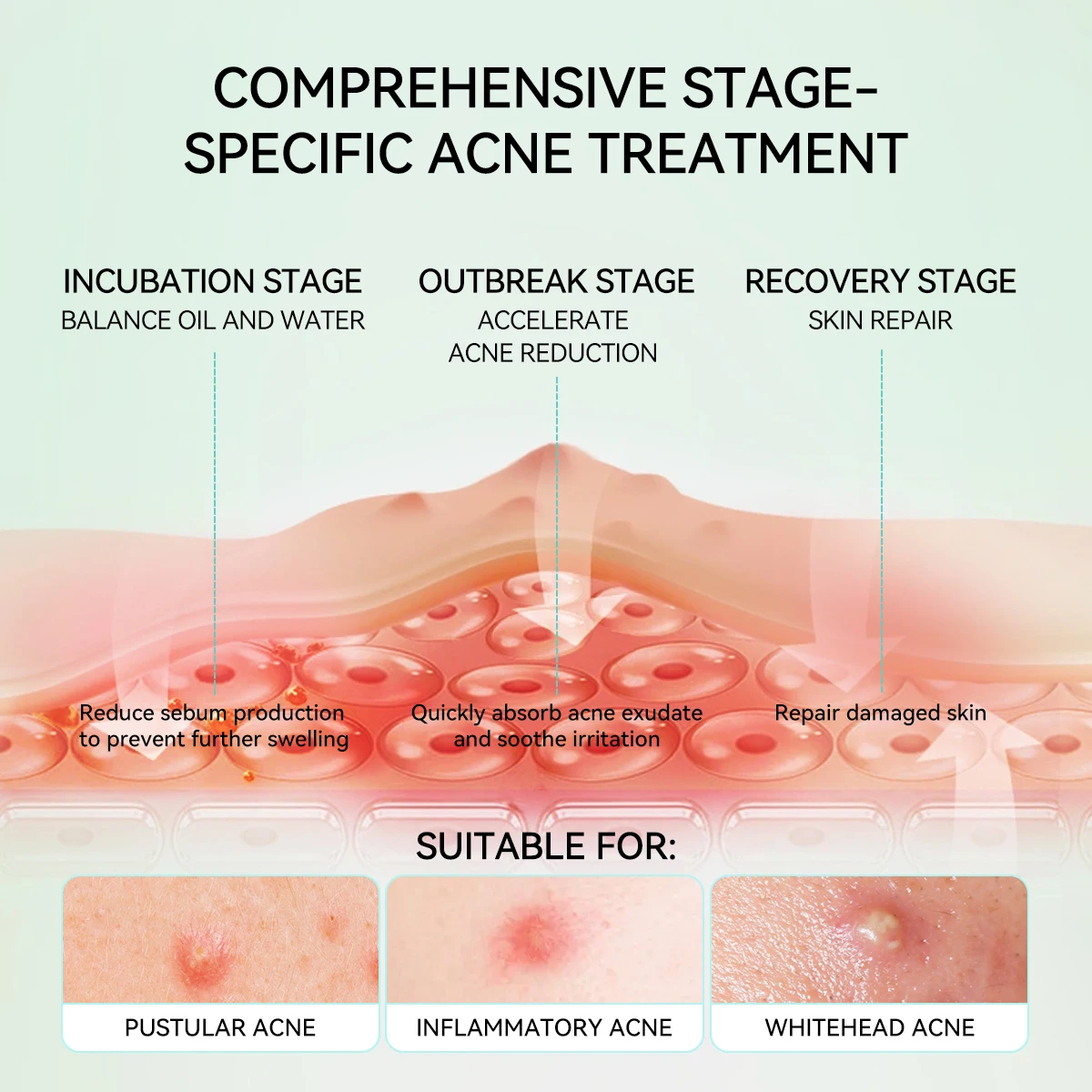 Lanbena  Night Use Private Label Ance Pimple Patch for All Skin Type Hydrocolloid factory