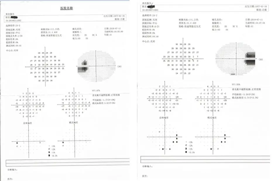 BIO-1100 High Accuracy Eye Examination Ophthalmic Instrument Visual Field Machine Projection Perimeter