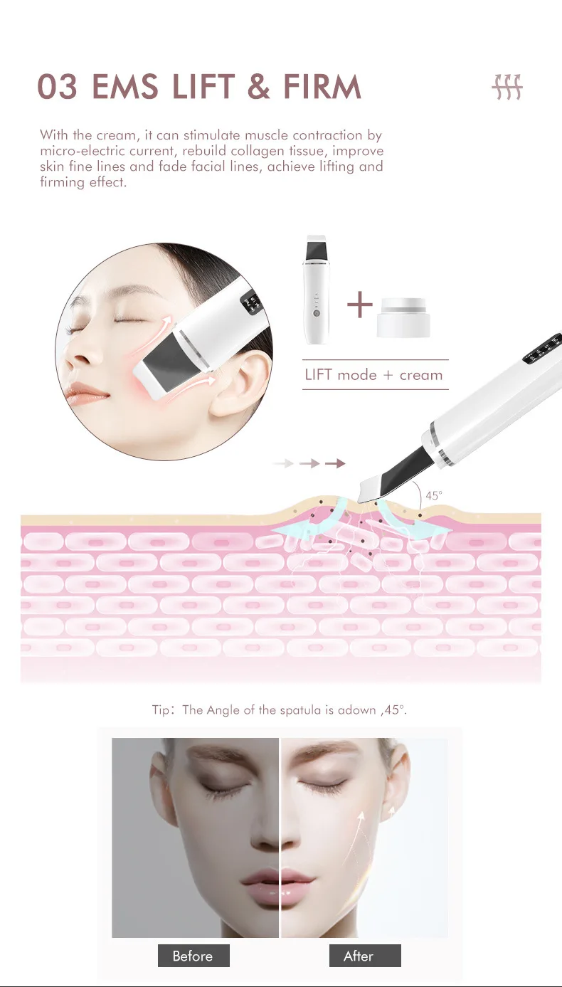 Professional Manufacturer Deep Face Cleaning Ultrasonic Skin Scrubber ...