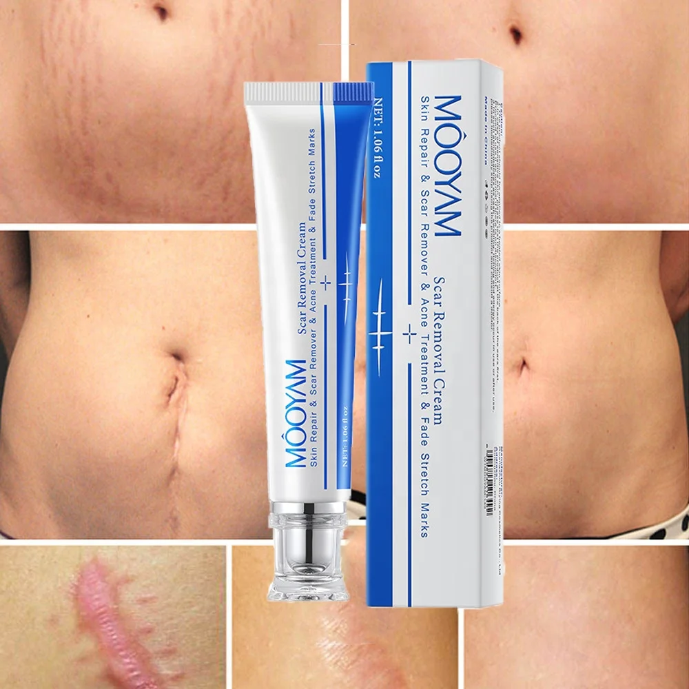 Private Label Fastest Strong Effective Acne Scar Removal Cream Acar Gel Bruises Repair Tummy Tuck Cream