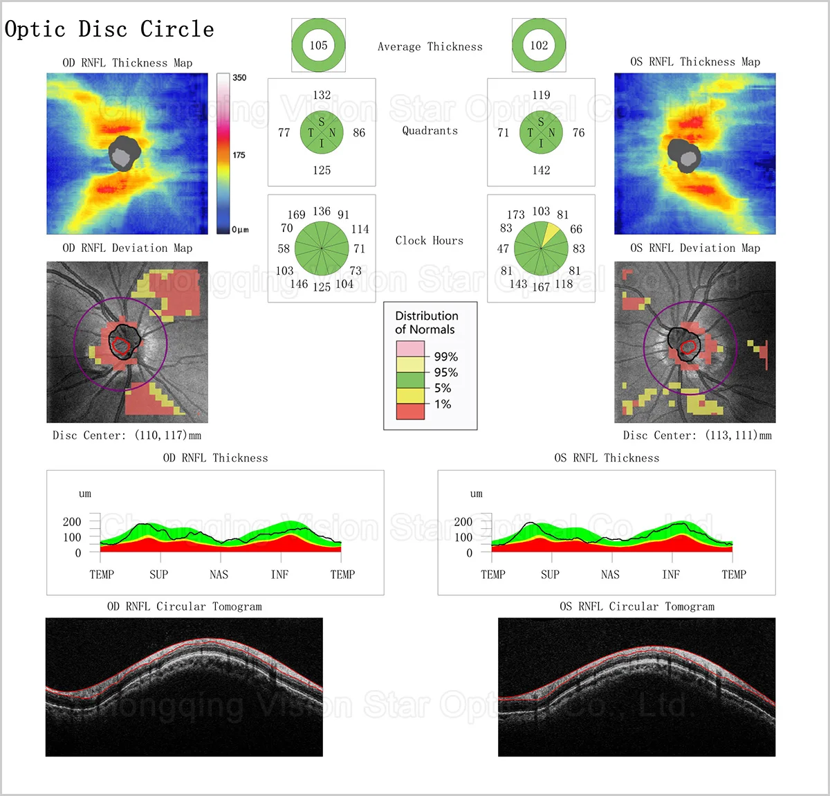 Retiview-500 OCT Machine for Eye Exams - 1 Year Warranty