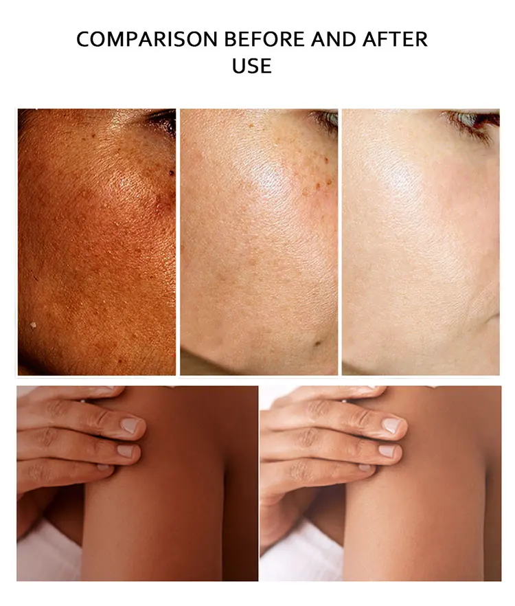 Lot De 2 Poudres éclaircissantes My Cherry Akhera - L-Glutathion, Anti-âge - Neuf