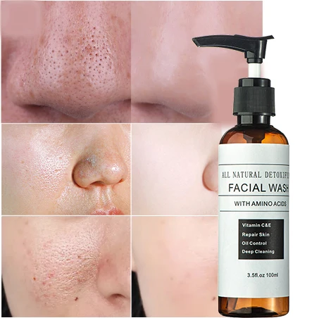 cbd face wash for acne