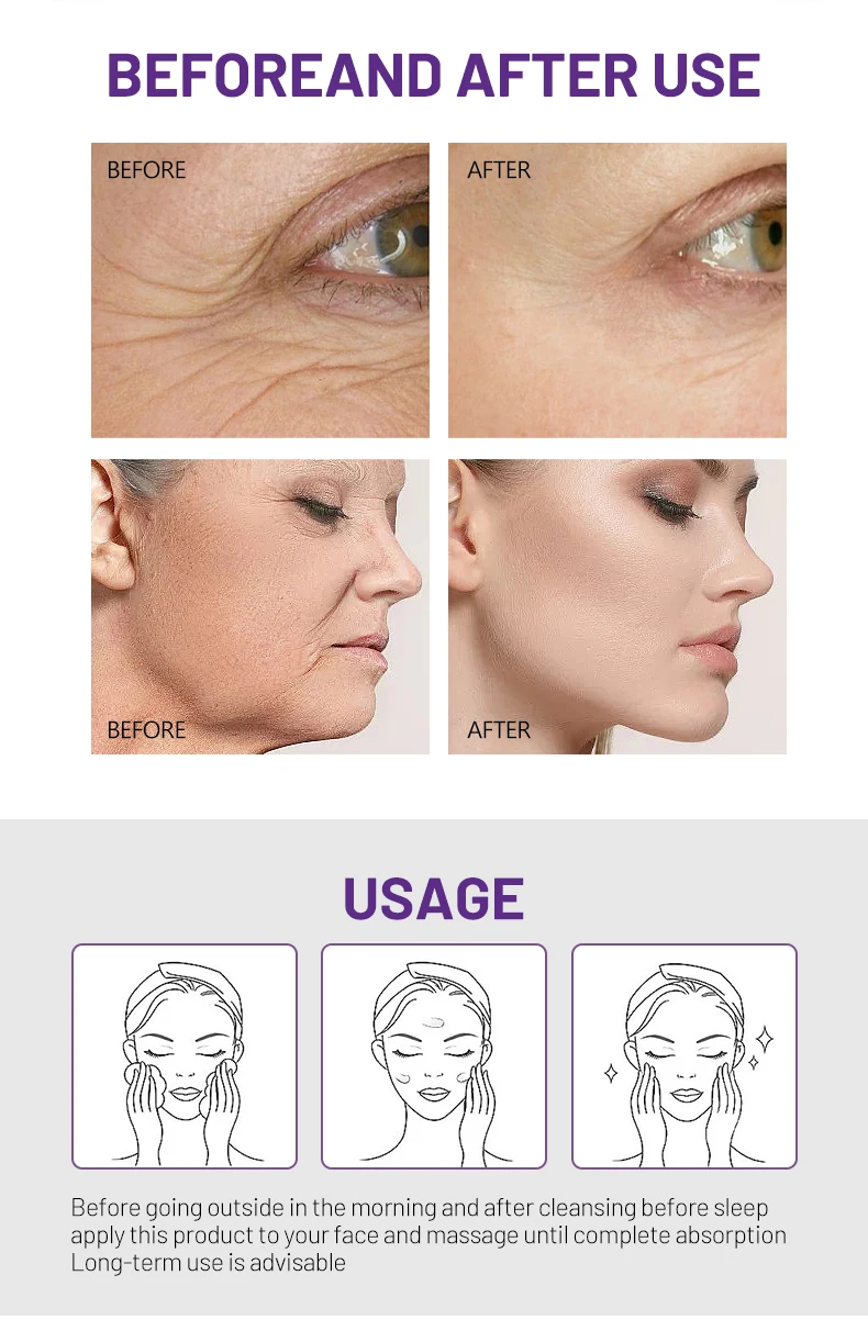Dissar Anti Aging Moisturizing Cream Whitening Moisturizer Collagen & Retinol Face Cream for Rejuvenating Skin