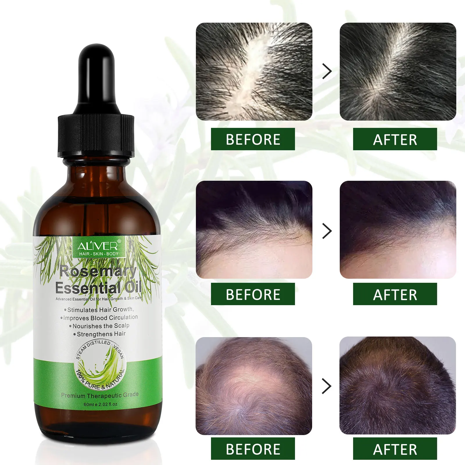 Aliver Nourishing Hair Repairing Growth Scalp Care Wholesale Rosemary Essential Oilhair Oil 2112