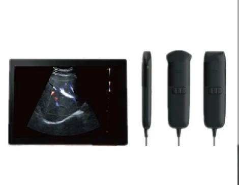 Vinno Ultrasound Machine VINNO Q5-7L Q+ Series High-end Handheld Color Doppler Diagnostic Device Ultrasound Color Doppler