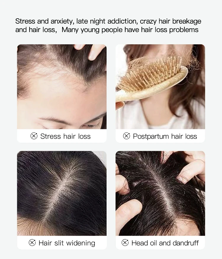 Customized Anti Dandruff Shampoo Organic Tea Tree Keratin Anti Hair