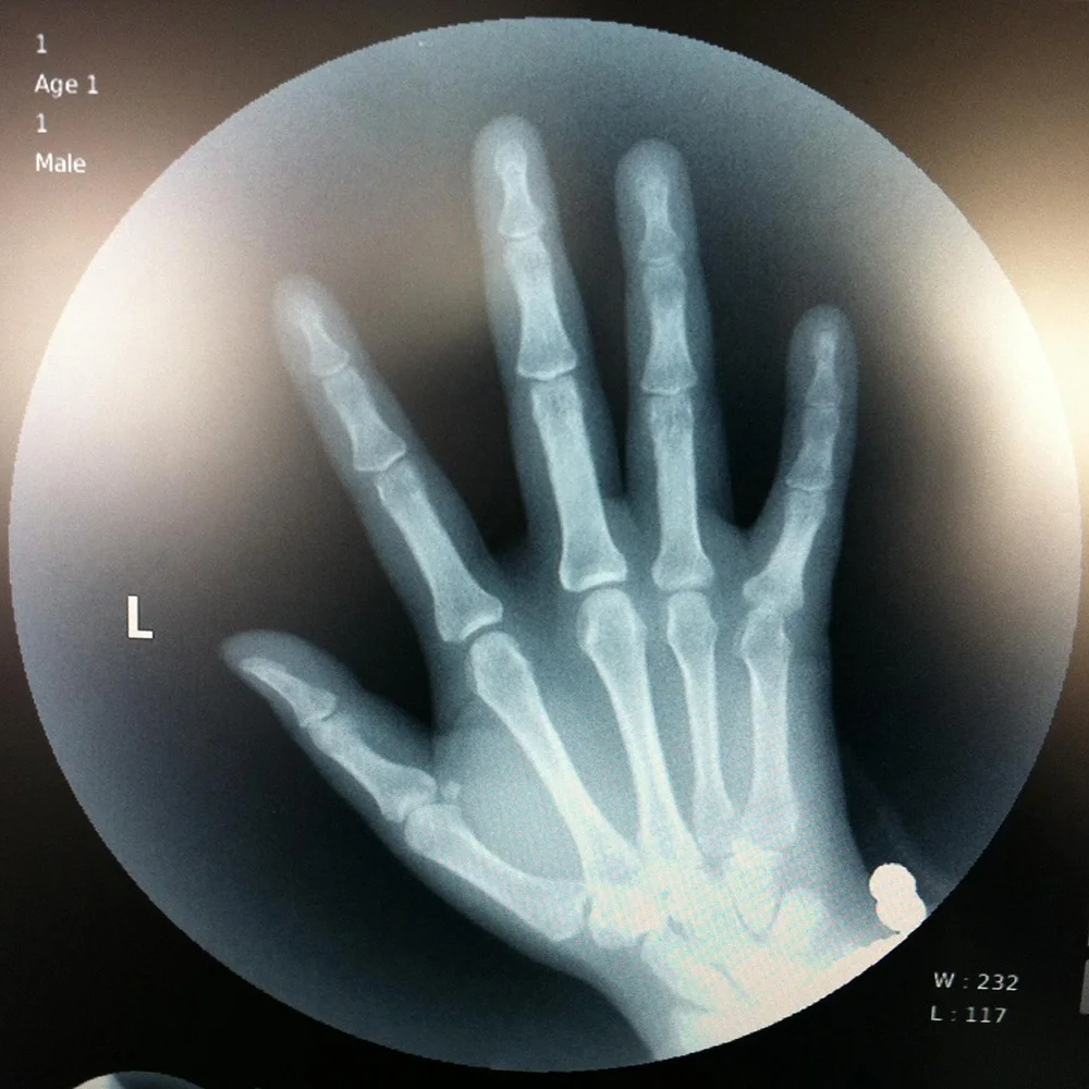 China Cheap Price High Frequency Portable Mobile c Arm System X Ray Machine