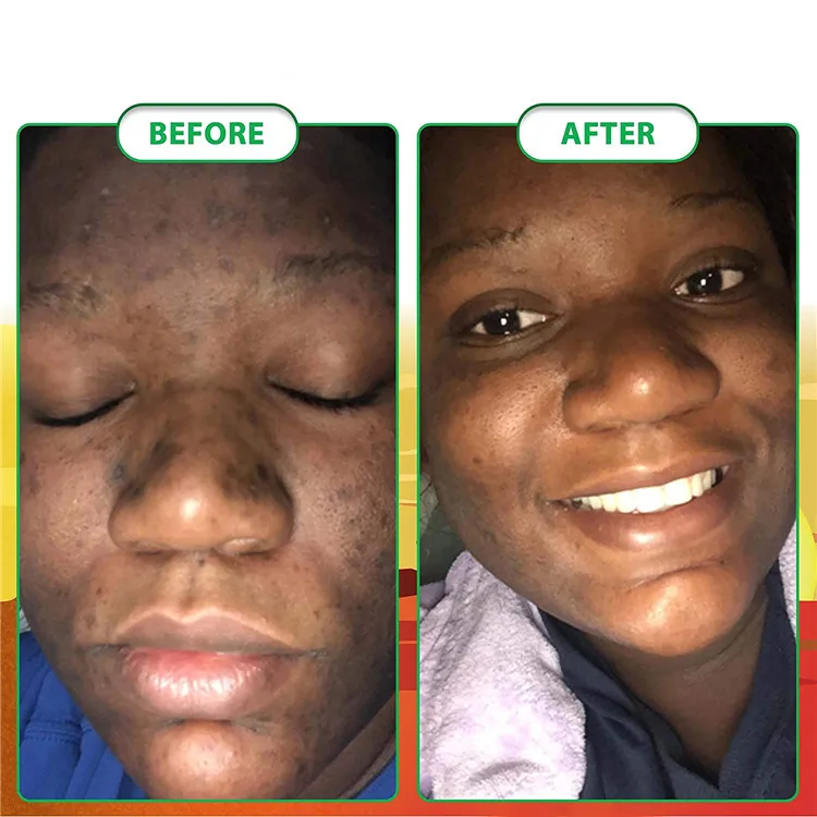 african black soap (9)
