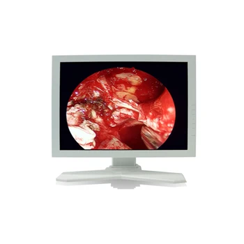 Display Suppliers Medical Lcd Display for Medical Equipments