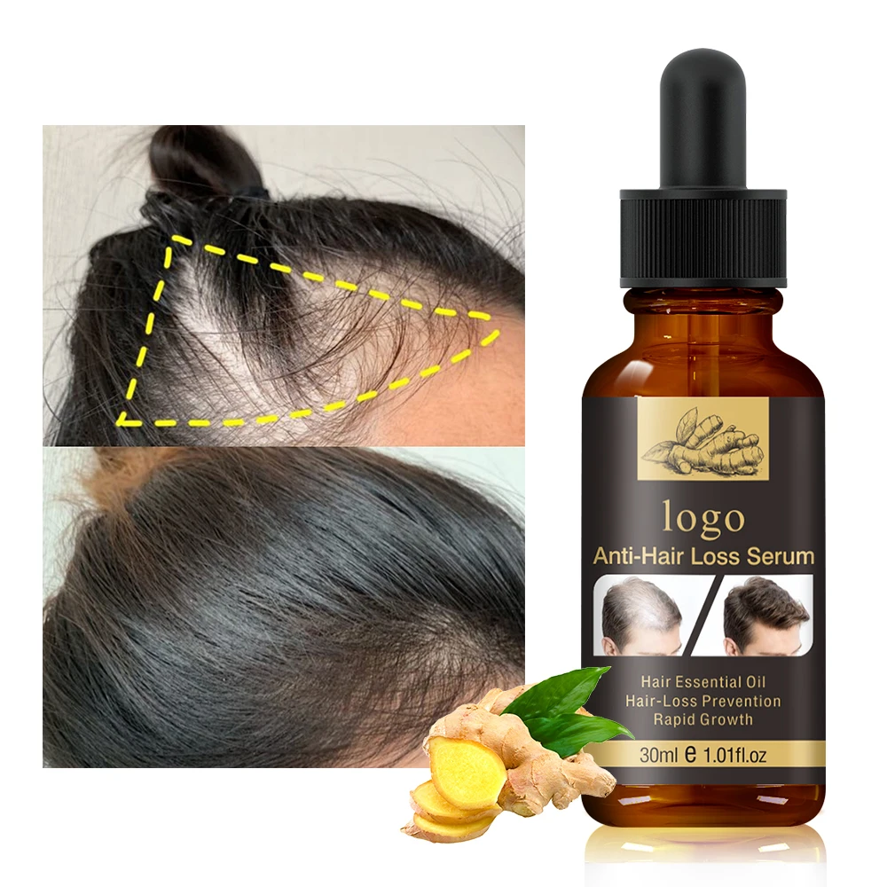 Wholesale 30ml Ginger Hair Growth Essential Oil Hair Loss Treatment