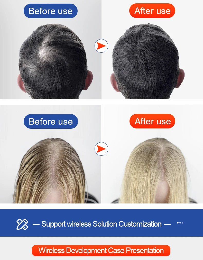 Laser Hair Growth Helmet Cap Fast Regrowth Red Light Therapy Laser Cap