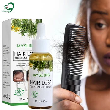 OEM Organic Strenthening Repair ingrown hair Serum Extract Hair Growth Oil bottles for black women ordinary