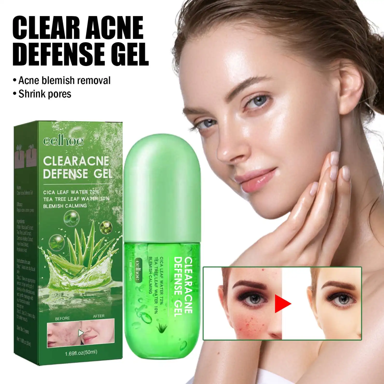 Alibaba.com: eelhoe 2023072003 Aloe Vera Clear Acne Defense Gel,  Moisturizing and Skin Perfecting, Ideal for all skin types : Low MOQ and  OEM/ODM services available.
