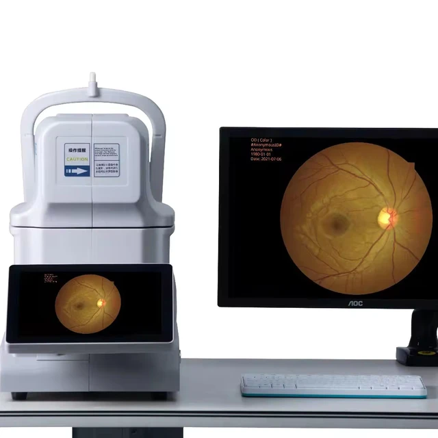 RetiCam3100 China top quality ophthmic equipment auto retinal eye fundus camera with FFA FAF optional