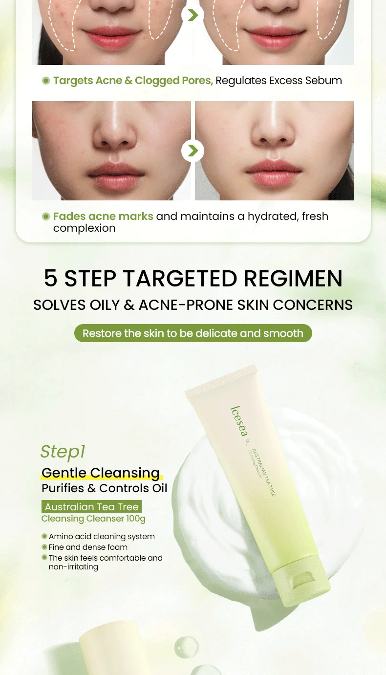 Icesea Australian Tea Tree Acne Solution Set - Daily Oil-Reducing Skincare Kit for Teen & Adult Acne, Clear Skin Essentials(pic6)